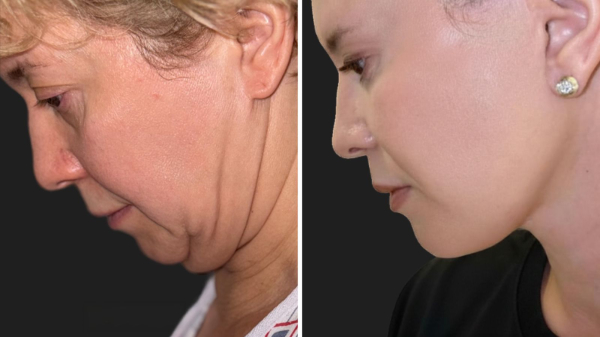 Image may contain Head Person Face Body Part Neck and Adult